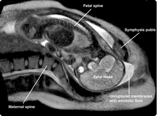 Illustration for article titled First Ever MRI Video Shows Childbirth from the Inside